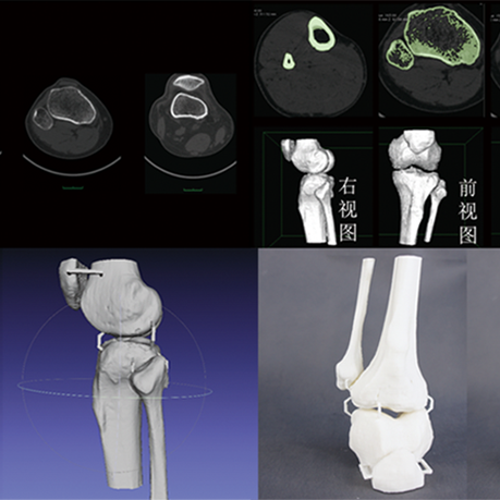 CTάؽģͣģ;ϸģ޸ģ3Dӡٳ