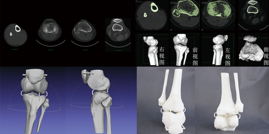 CTάؽģģ;ϸģ޸ģ3Dӡٳ