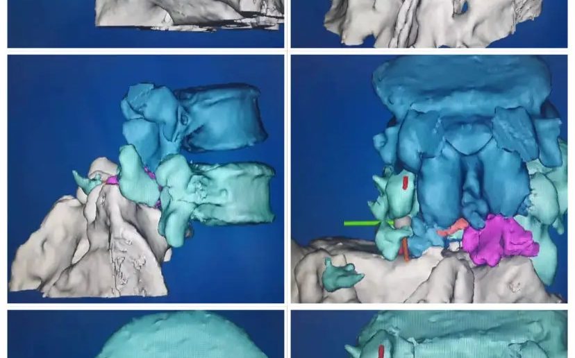 3DӡģԽֱۡ˽⻼ߵĲƶӦƻ߽Ƽƻ.webp