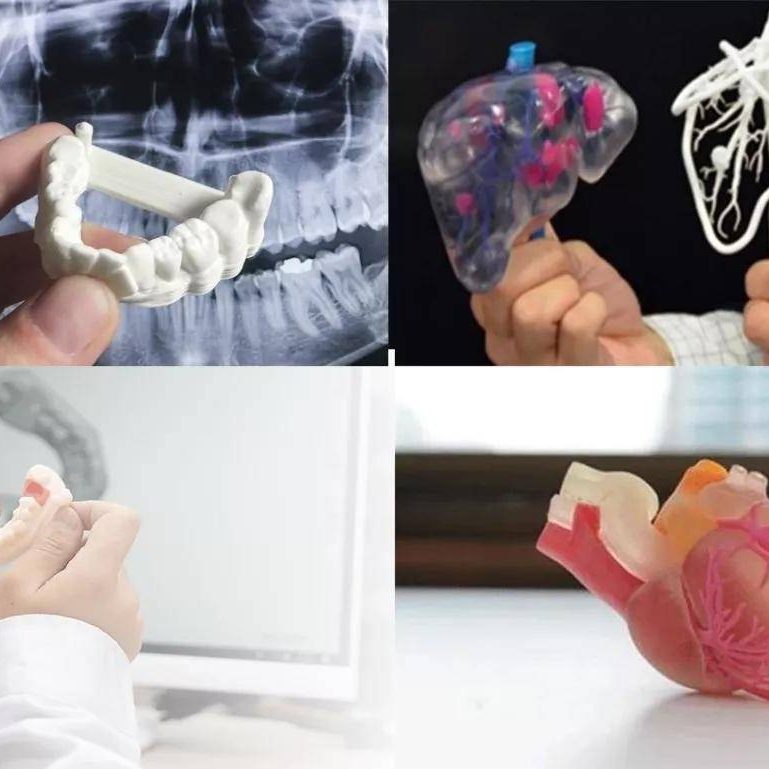 CTάؽҽѧ3DӡڹǿеľӦ