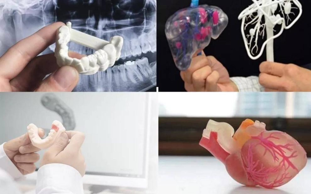 CTάؽҽѧ3DӡڹǿеľӦ